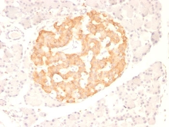 TNF alpha Antibody