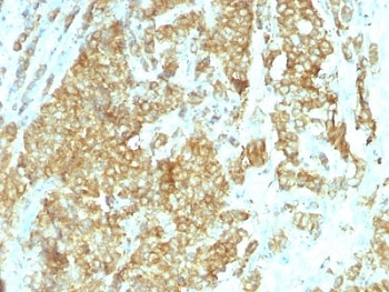GRP94 Antibody / HSP90B1