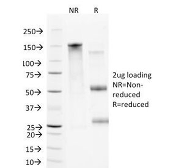 VCAM-1 Antibody