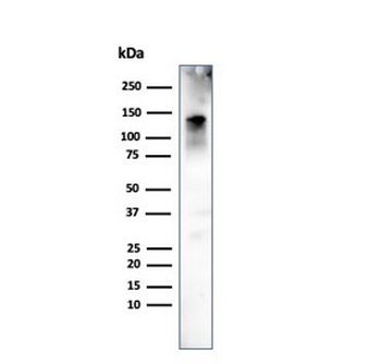 Caldesmon / CAD Antibody HMW