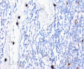 Myeloid Marker / MYADM Antibody