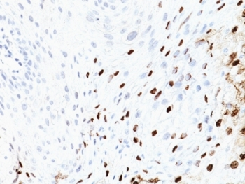HPV-16 L1 Antibody