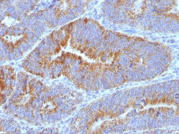 Thomsen-Friedenreich Antigen Antibody / CD176