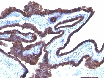 Cytokeratin 8/18 Antibody Cocktail