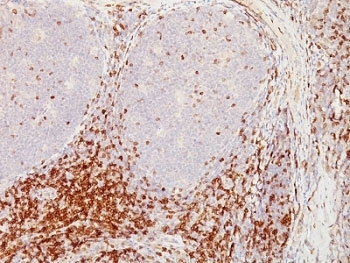CD5 Antibody