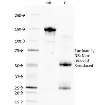 Hepatocyte Specific Antigen Antibody