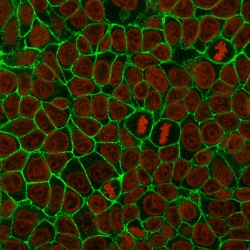 E-Cadherin Antibody / CDH1