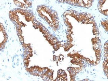 Cytokeratin 8/18 Antibody