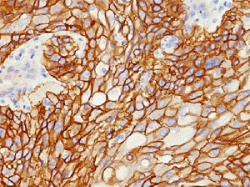 EGF Receptor / EGFR Antibody