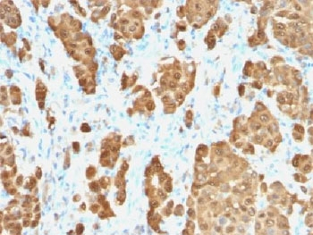 S100B Antibody