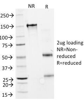 Interferon alpha 2 Antibody / IFNA2