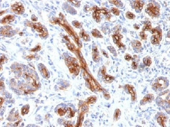 CFTR Antibody / Cystic Fibrosis Transmembrane Regulator
