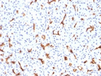CFTR Antibody / Cystic Fibrosis Transmembrane Regulator