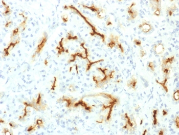 CFTR Antibody / Cystic Fibrosis Transmembrane Regulator