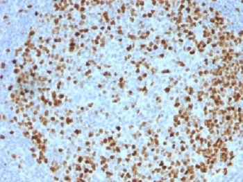 Topoisomerase II alpha Antibody / TOP2A