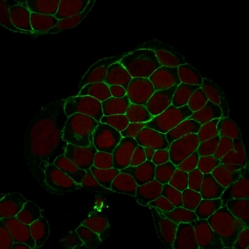 EpCAM Antibody