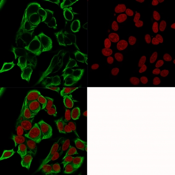 EpCAM Antibody