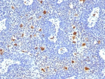 HPV-16 E6 Antibody