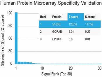 S100B Antibody