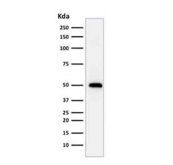 p53 Antibody / TP53
