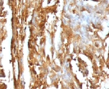 Beta-2 Microglobulin Antibody