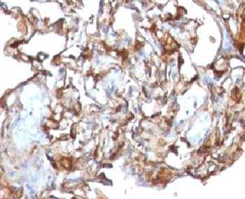 CD146 Antibody / MCAM / MUC18