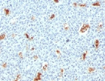 S100A9 Antibody / MRP14 / Calgranulin B / Calprotectin L1H