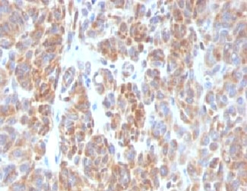Bcl-2 Antibody