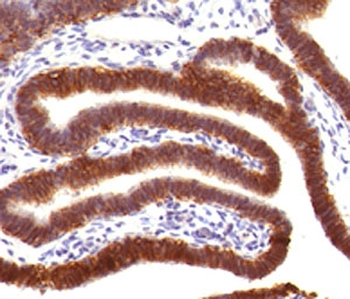 EpCAM Antibody / Extracellular domain