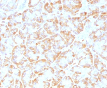 VLDLR Antibody / VLDL Receptor