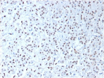 WT1 Antibody / Wilms Tumor 1