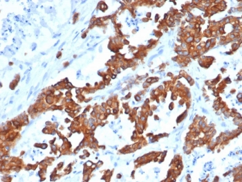 EpCAM Antibody