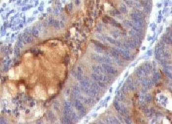 Secretory Component p85 Antibody / ECM1