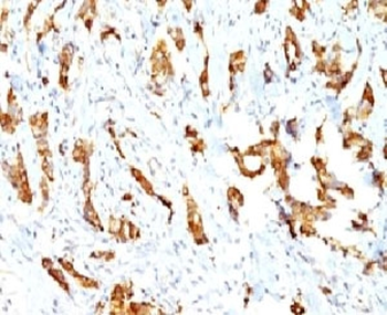 HSP27 Antibody / HSPB1