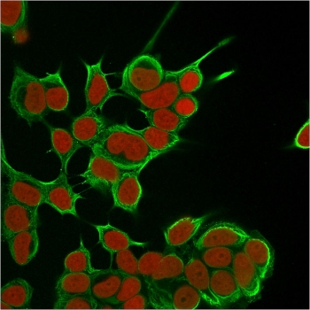 KRT8 Antibody / Cytokeratin 8