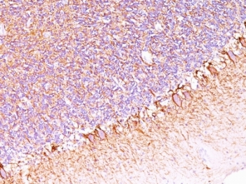Neurofilament Antibody (-Heavy) / NF-H / NEFH