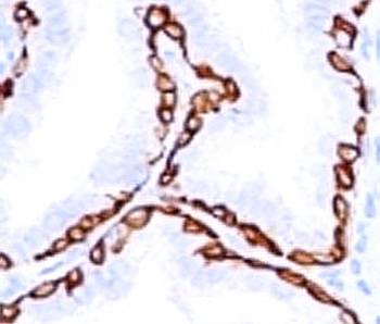 Cytokeratin 14 Antibody / CK14 / KRT14