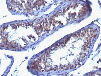 Prolactin Receptor Antibody / PRLR