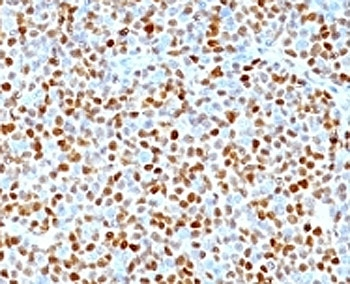 Cyclin D1 Antibody / CCND1