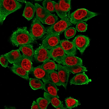 Alpha Actin Antibody / ACTA2 (smooth muscle)
