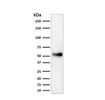 p53 Antibody / TP53