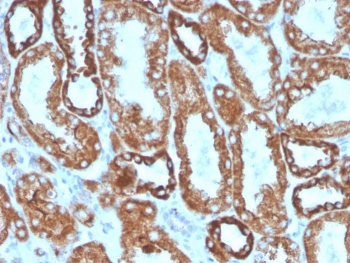 Interferon gamma Antibody / IFNG
