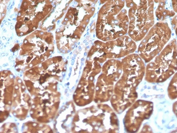 FTL Antibody / Ferritin Light Chain