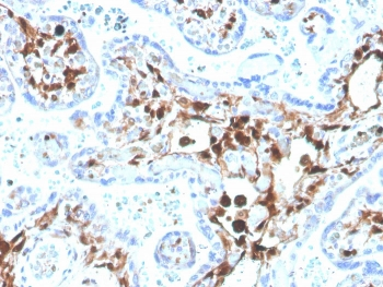 S100A4 Antibody / FSP1