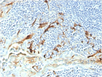 Mesothelin Antibody / MSLN