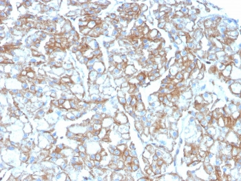 PD-L1 Antibody / B7-H1 / CD274