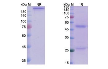 Andecaliximab (MMP9) - Research Grade Biosimilar