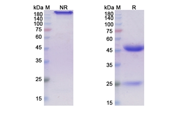 Girentuximab (CA9) - Research Grade Biosimilar Antibody