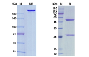 Maftivimab (Zaire Ebola virus) - Research Grade Biosimilar Antibody