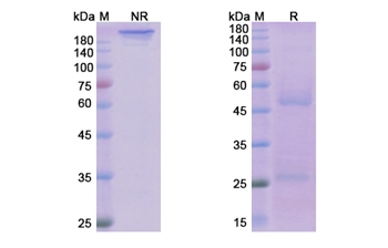 Ofatumumab (MS4A1/CD20) - Research Grade Biosimilar Antibody